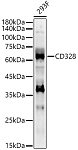 Western blot - CD328 Rabbit pAb (A22679)