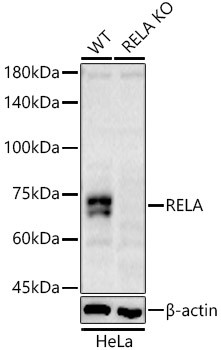 [KO Validated] RELA Rabbit polyclonal antibody