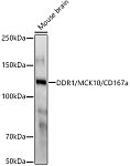 Western blot - DDR1/MCK10/CD167a Rabbit mAb (A22705)