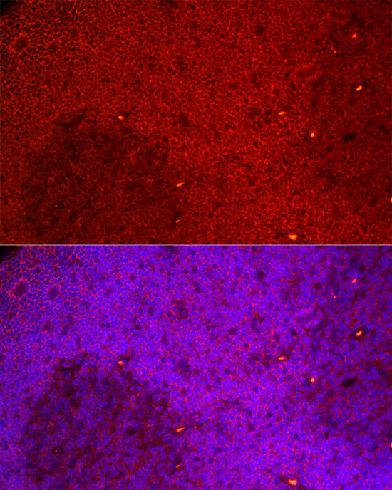 NFATC3 Rabbit monoclonal antibody