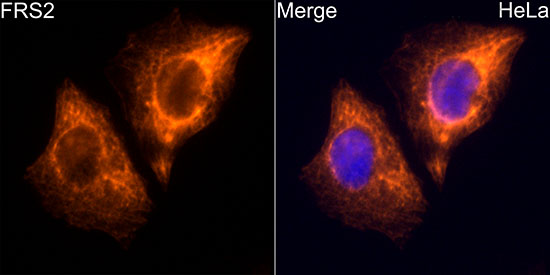 FRS2 Rabbit monoclonal antibody