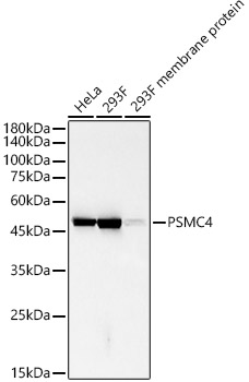 PSMC4 Rabbit monoclonal antibody