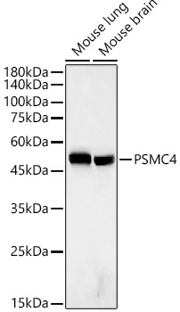 PSMC4 Rabbit monoclonal antibody