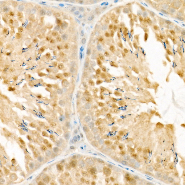 PSMC4 Rabbit monoclonal antibody
