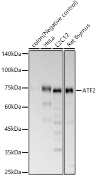 ATF2 Rabbit monoclonal antibody