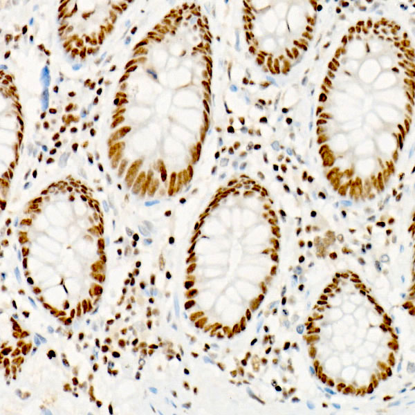 ATF2 Rabbit monoclonal antibody