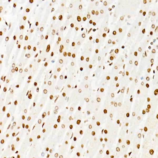ATF2 Rabbit monoclonal antibody