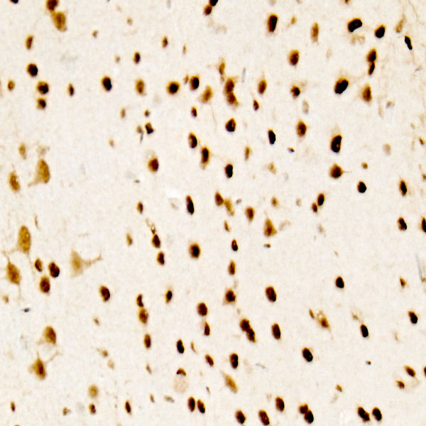 ATF2 Rabbit monoclonal antibody