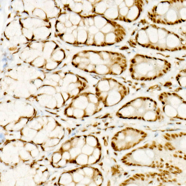 ATF2 Rabbit monoclonal antibody