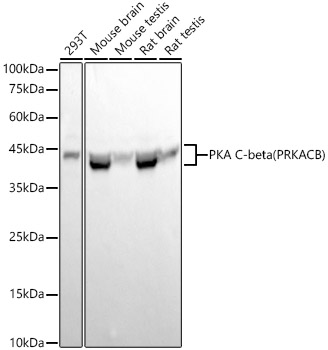 PKA C-beta (PRKACB) Rabbit monoclonal antibody
