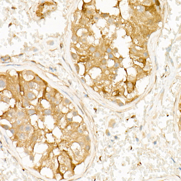 PKA C-beta (PRKACB) Rabbit monoclonal antibody