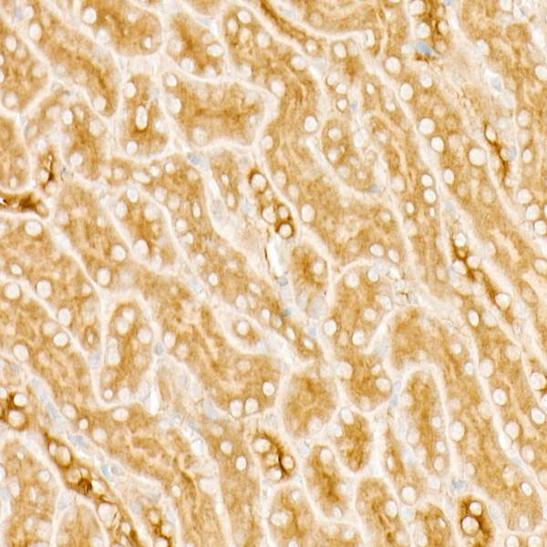 PKA C-beta (PRKACB) Rabbit monoclonal antibody