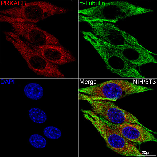 PKA C-beta (PRKACB) Rabbit monoclonal antibody