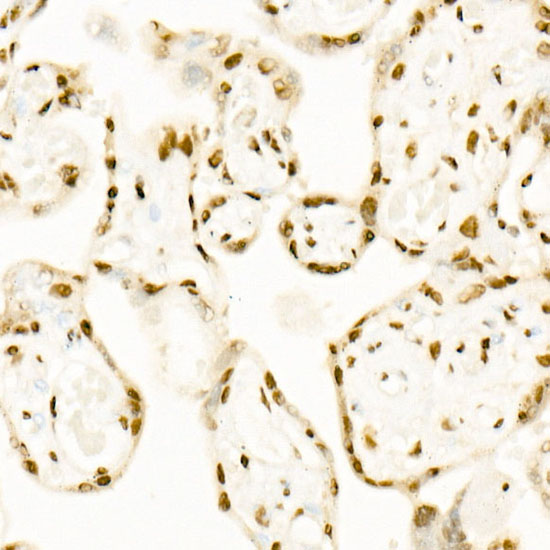 QKI Rabbit monoclonal antibody