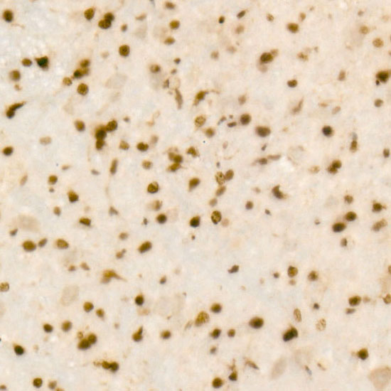 QKI Rabbit monoclonal antibody