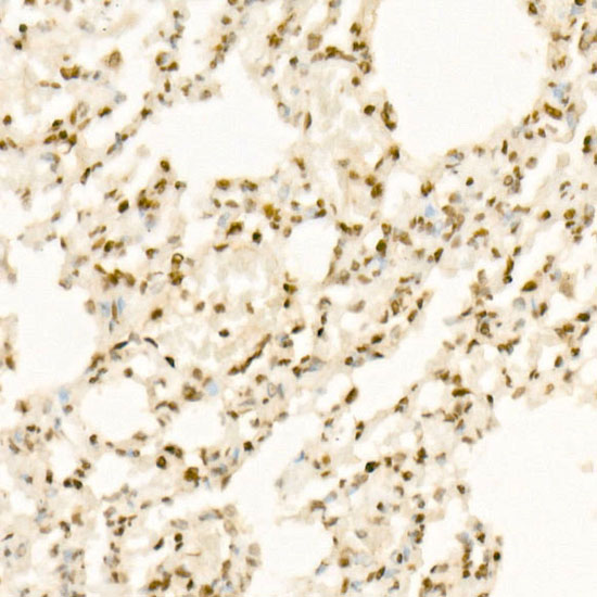 QKI Rabbit monoclonal antibody