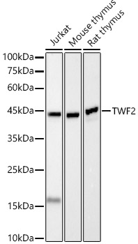 TWF2 Rabbit monoclonal antibody