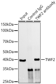 TWF2 Rabbit monoclonal antibody