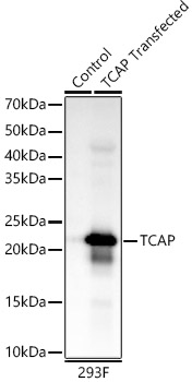 TCAP Rabbit monoclonal antibody