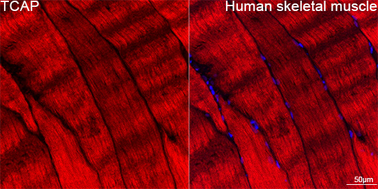 TCAP Rabbit monoclonal antibody