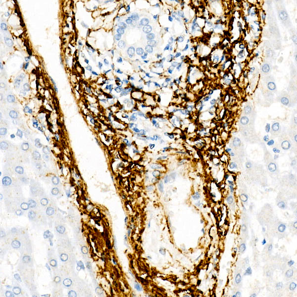 ELN Rabbit monoclonal antibody