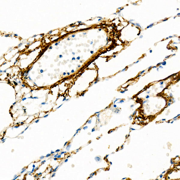 ELN Rabbit monoclonal antibody