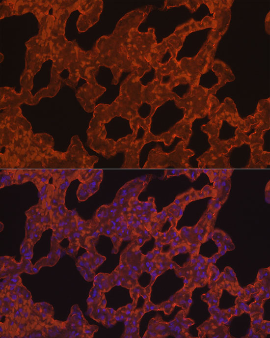 ELN Rabbit monoclonal antibody