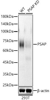 [KD Validated] PSAP Rabbit monoclonal antibody