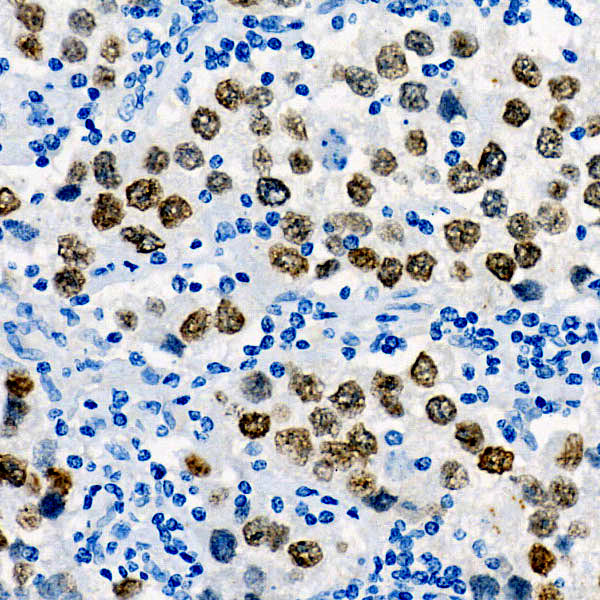 Sall4 Rabbit monoclonal antibody