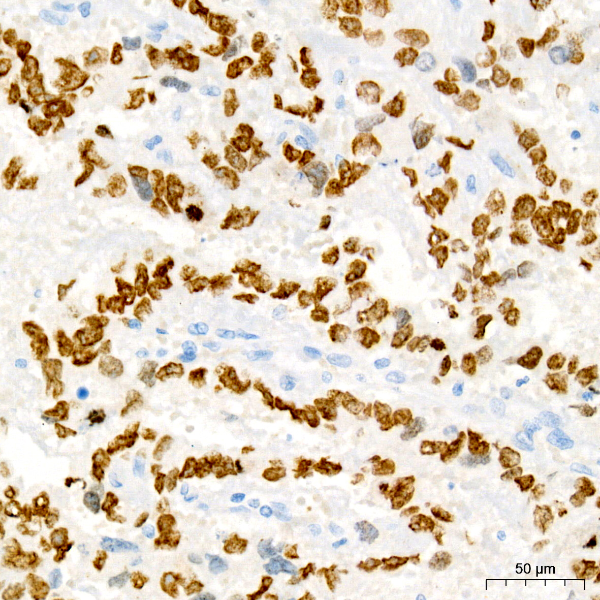 Sall4 Rabbit monoclonal antibody