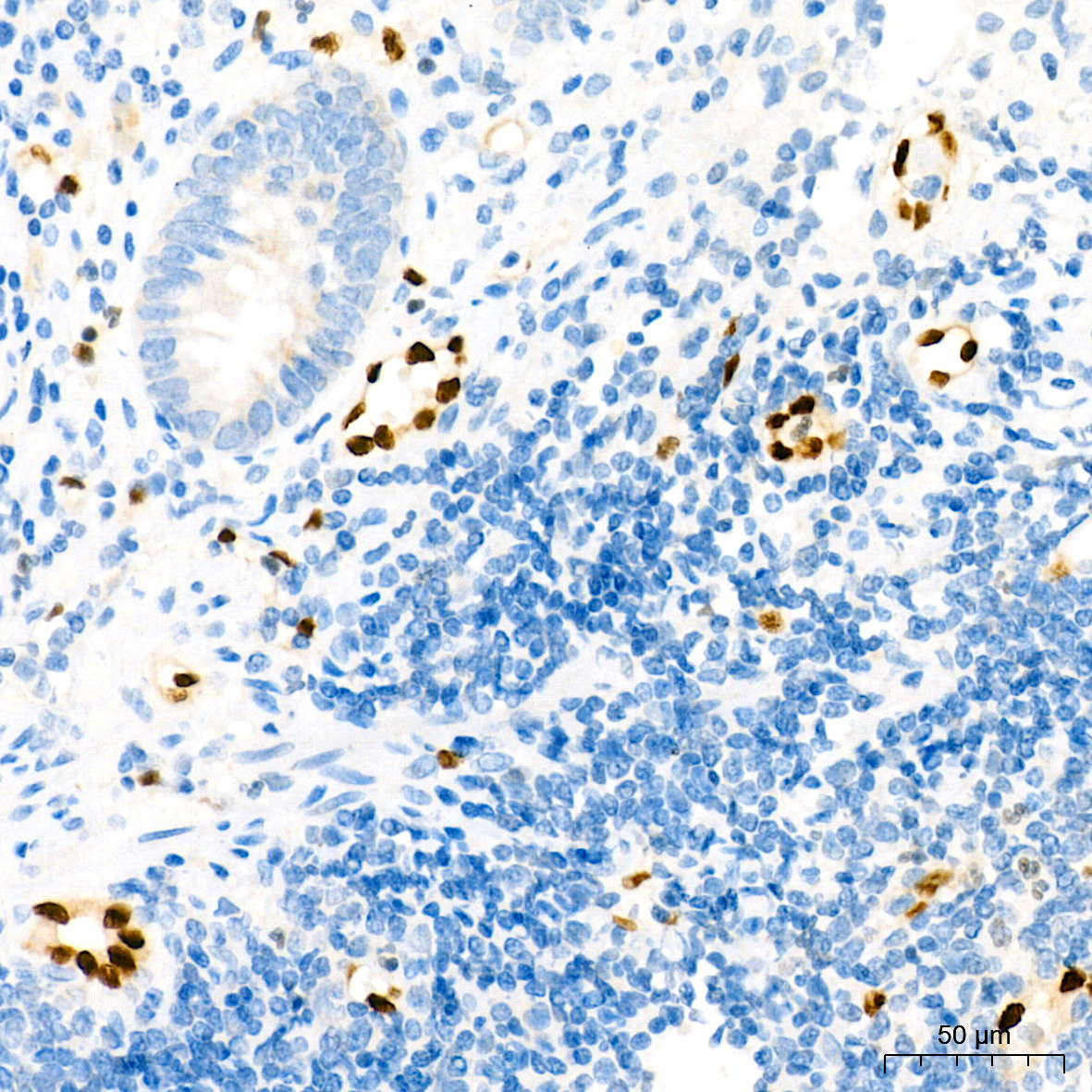 ERG Rabbit monoclonal antibody