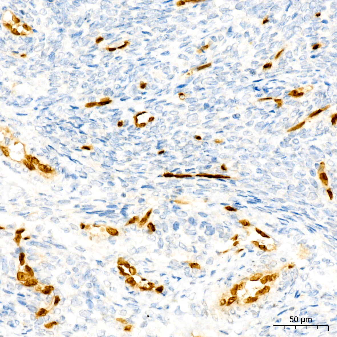 ERG Rabbit monoclonal antibody