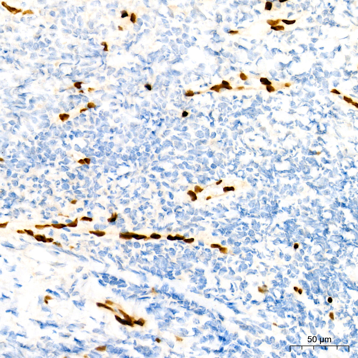 ERG Rabbit monoclonal antibody