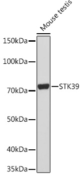 STK39 Rabbit monoclonal antibody