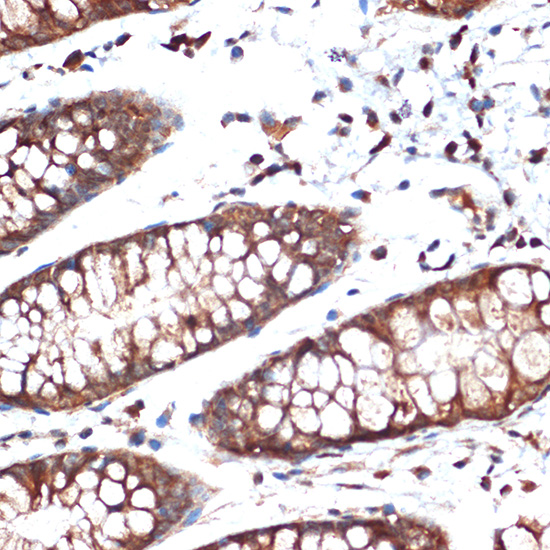STK39 Rabbit monoclonal antibody