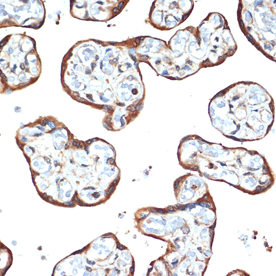 STK39 Rabbit monoclonal antibody