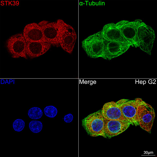 STK39 Rabbit monoclonal antibody
