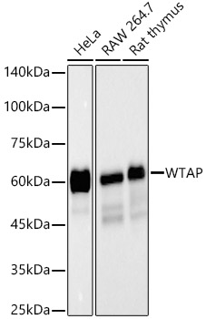 WTAP Rabbit monoclonal antibody