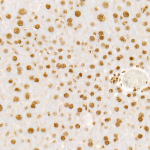 WTAP Rabbit monoclonal antibody