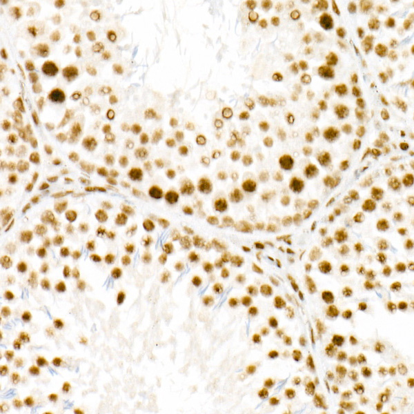 WTAP Rabbit monoclonal antibody