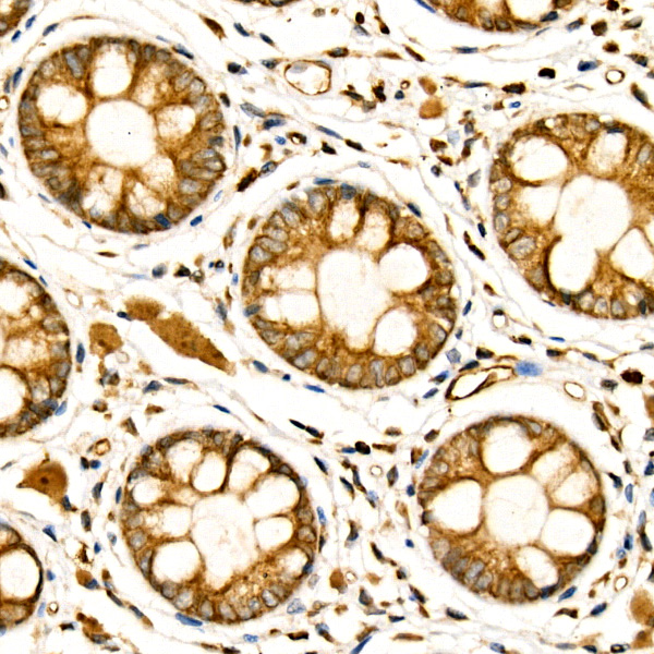 NGLY1 Rabbit monoclonal antibody