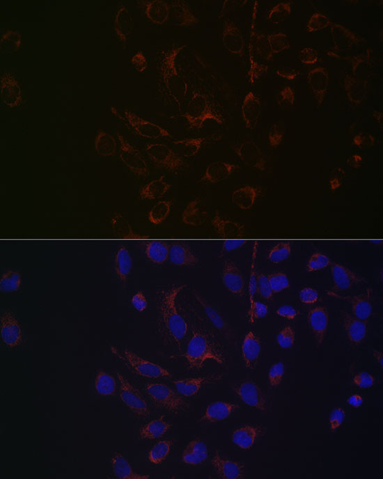 NGLY1 Rabbit monoclonal antibody