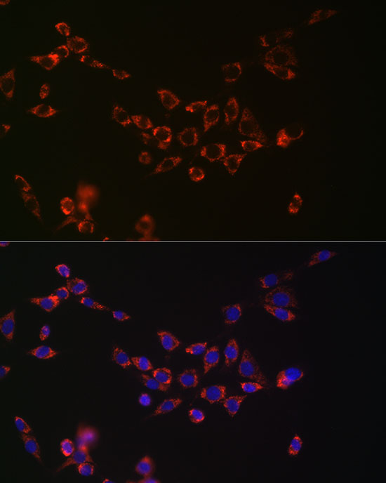 NGLY1 Rabbit monoclonal antibody