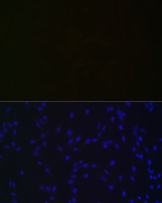 NGLY1 Rabbit monoclonal antibody