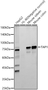 TAP1 Rabbit monoclonal antibody