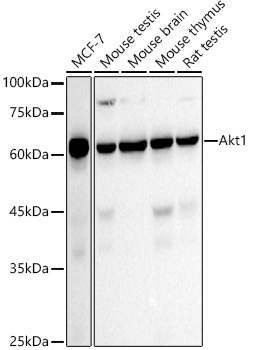 [KO Validated] AKT1 Rabbit monoclonal antibody