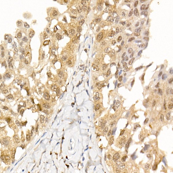 [KO Validated] AKT1 Rabbit monoclonal antibody