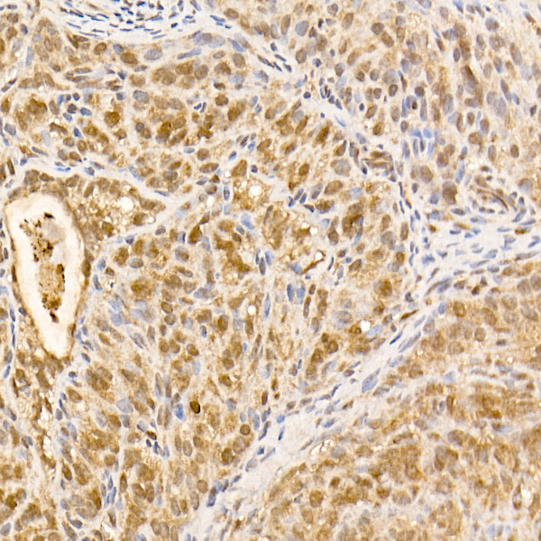 [KO Validated] AKT1 Rabbit monoclonal antibody