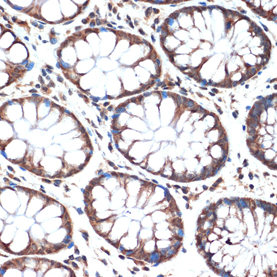 SMURF2 Rabbit monoclonal antibody