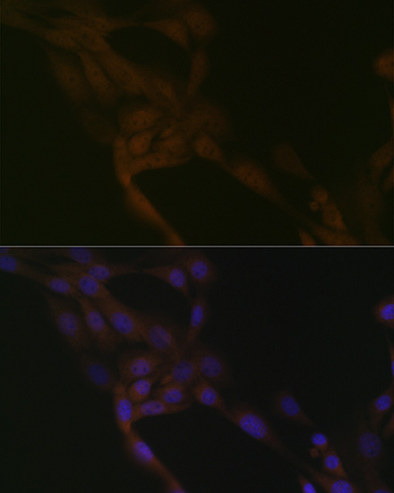 SMURF2 Rabbit monoclonal antibody